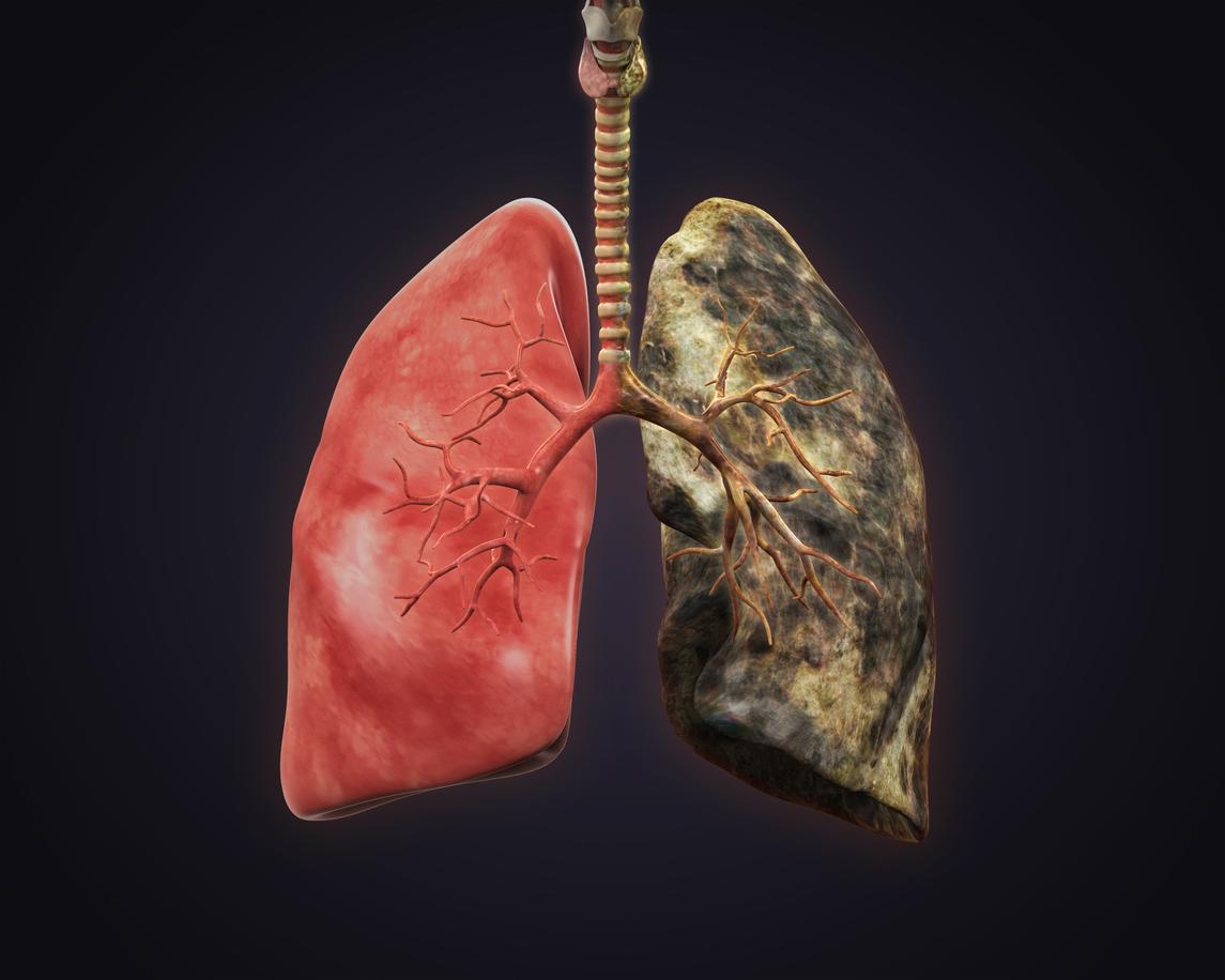 Formas naturales de limpiar tus pulmones